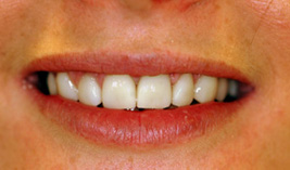 cosmetic-after cosmetic-after