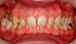 cosmetic-before cosmetic-before